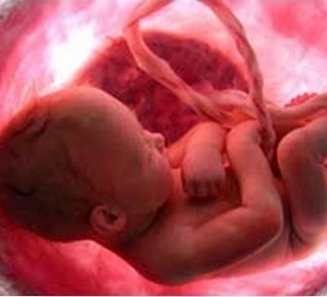 nascituro 1 300×272